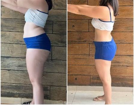 Antes e depois — Carla M.