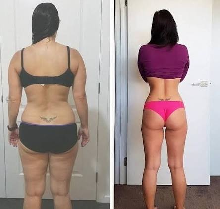Antes e depois — Fernanda L.